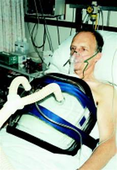 High Pressure Ventilator