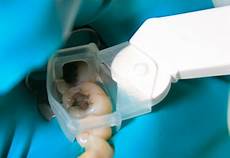Plastic Aspirator
